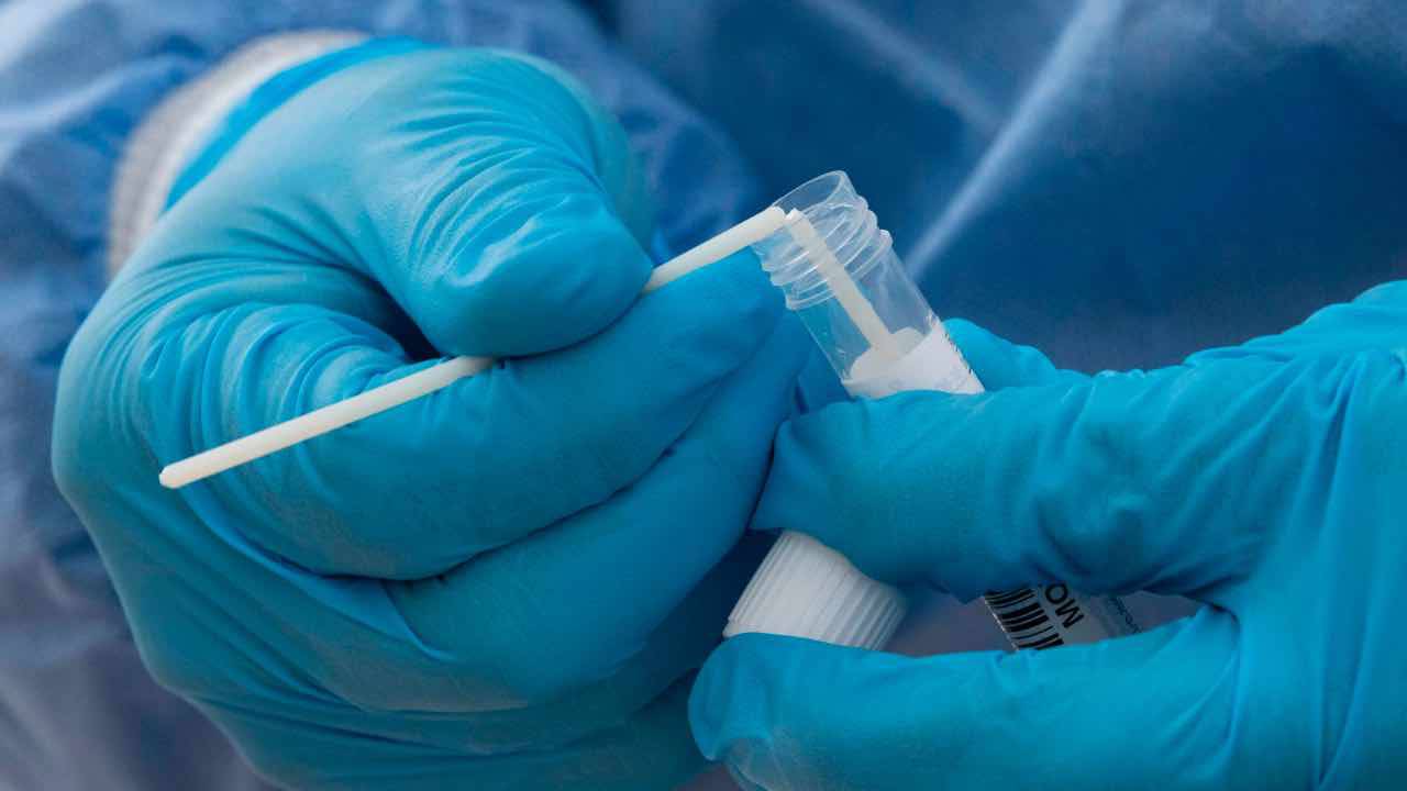 Ue: via libera ai test antigenici rapidi comuni