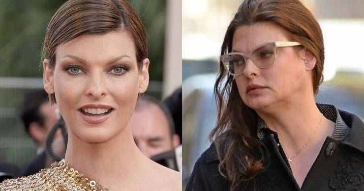 Linda Evangelista sfigurata da un trattamento estetico