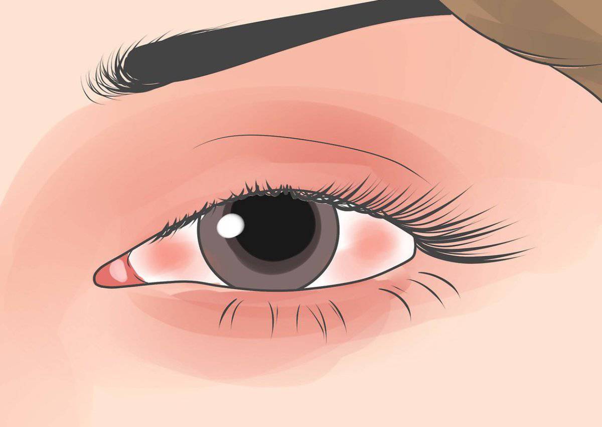 Occhio: ti trema spesso? Non sottovalutiamo il nostro corpo