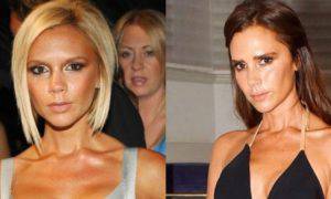 Victoria Beckham ritocchini chirurgo prima dopo 