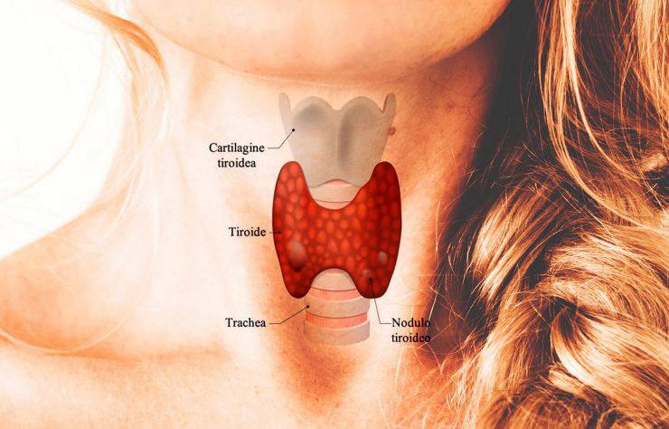 Here are the symptoms of hypothyroidism 