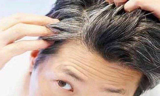 Capelli Bianchi: ecco da cosa derivano veramente