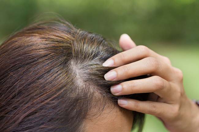 Capelli Bianchi: ecco da cosa derivano veramente