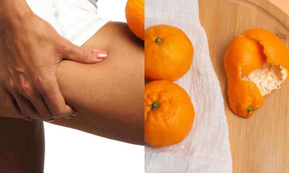 cellulite buccia mandarino