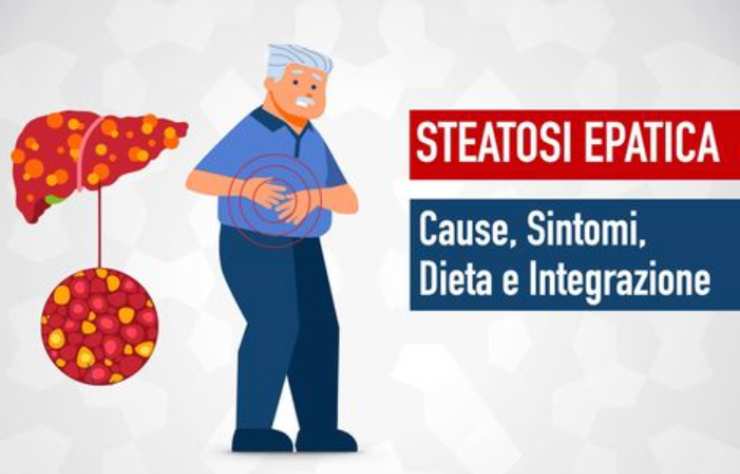 Steatosi epatica