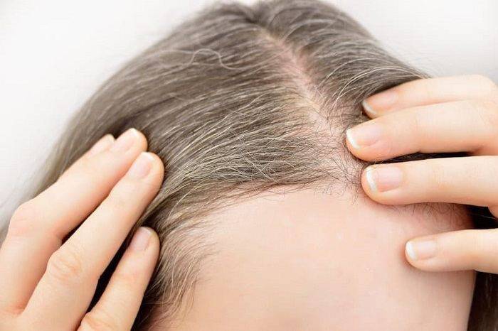 Capelli bianchi: perchè compaiono in età giovane