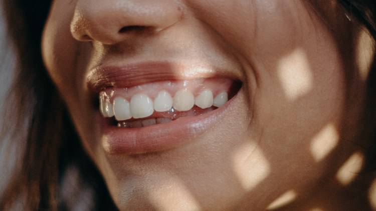 Denti: sorriso bianco splendente con il carbone vegetale (Pexels)