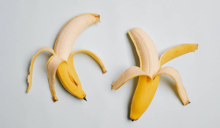 Banane (Pexels)