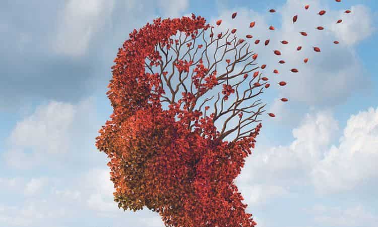 Alzheimer prevenzione cibi 
